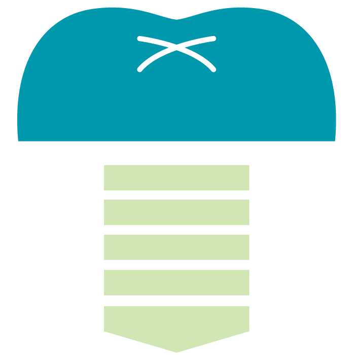 インプラント